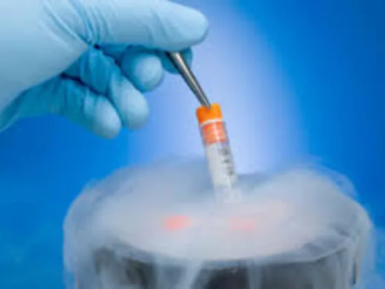 Semen-freezing